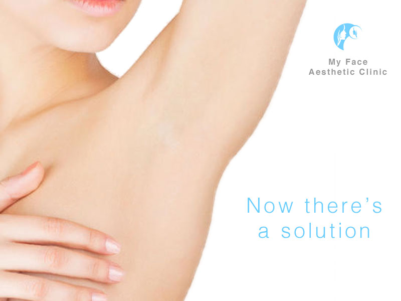 clinical treatments for excessive under arm sweating